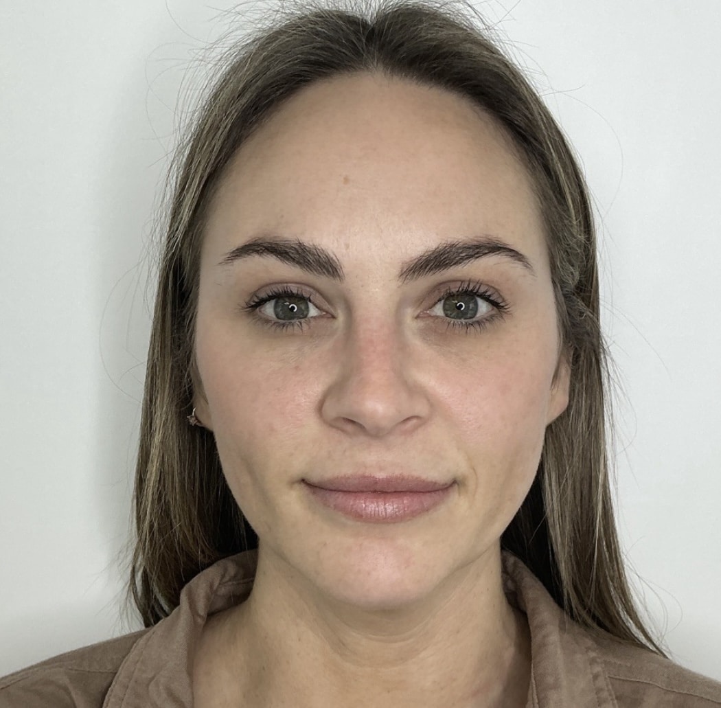 After Image: Neurotoxin - front