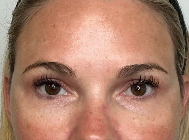 After Image: PDGF - other