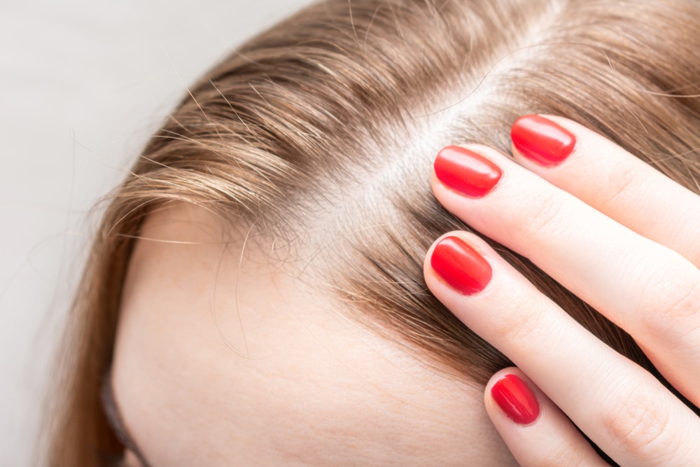 Closeup of woman’s thinning hair around her part